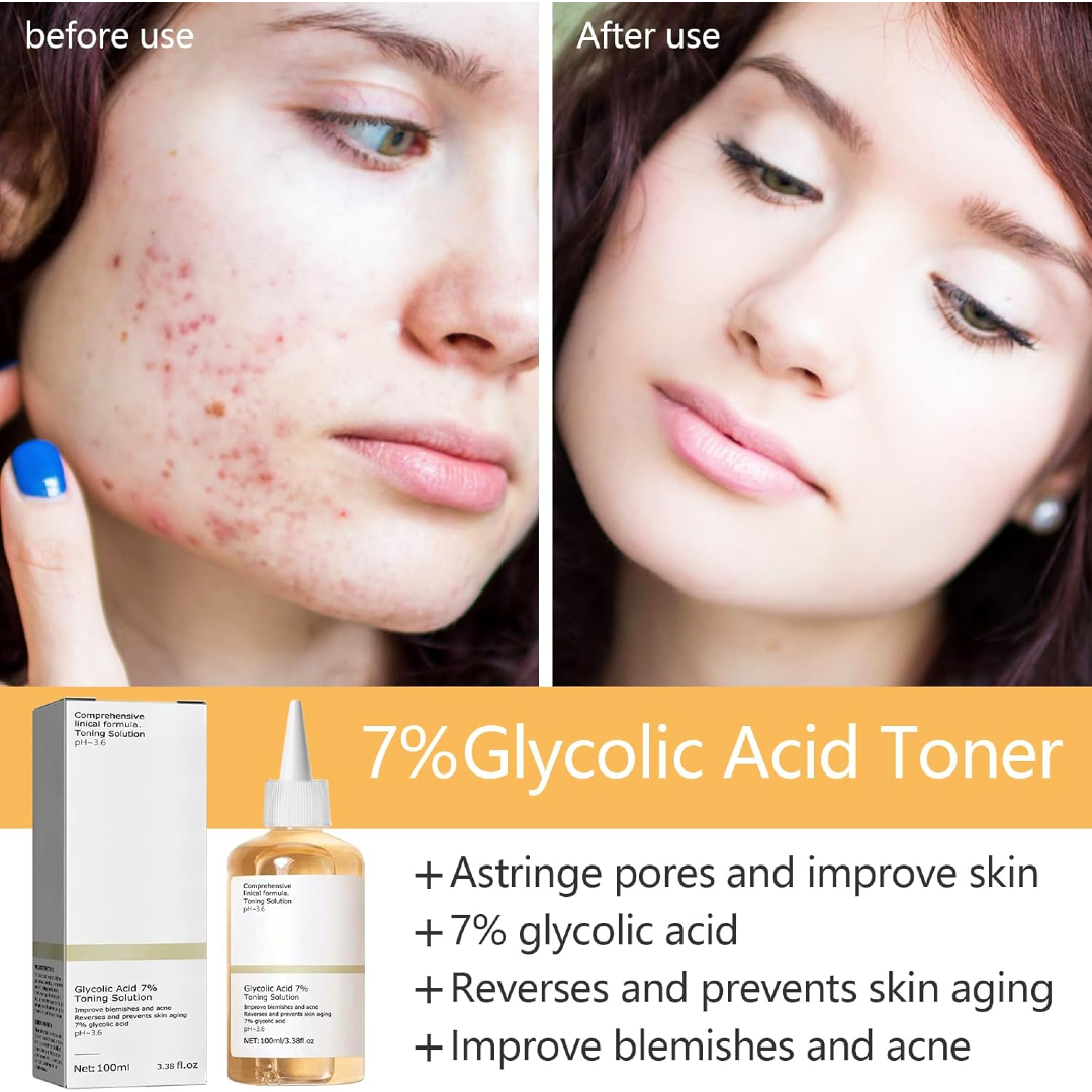 GlycoGlow 7% Exfoliating Toner – Clears Acne, Smooths Texture & Reveals Radiant Skin