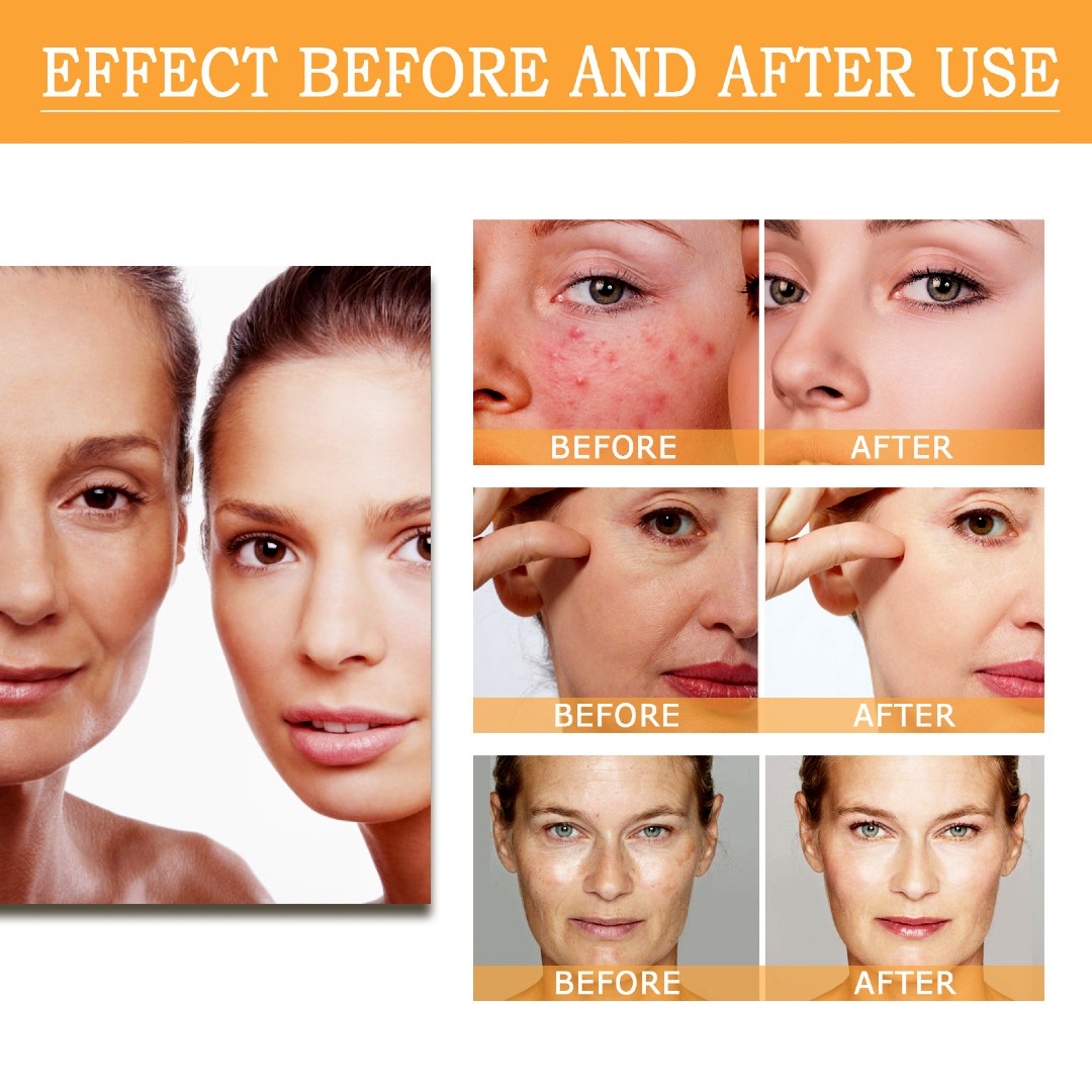 GlycoGlow 7% Exfoliating Toner – Clears Acne, Smooths Texture & Reveals Radiant Skin