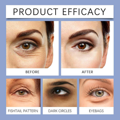 Before and after comparison of eye treatments on a person's eyes with labels for different issues.