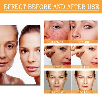 GlycoGlow 7 % Peeling-Toner – Beseitigt Akne, glättet die Hautstruktur und sorgt für strahlende Haut